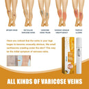 Laser Therapy Pen for Varicose Veins | Blue Light Treatment Device for Pain Relief & Circulation Improvement