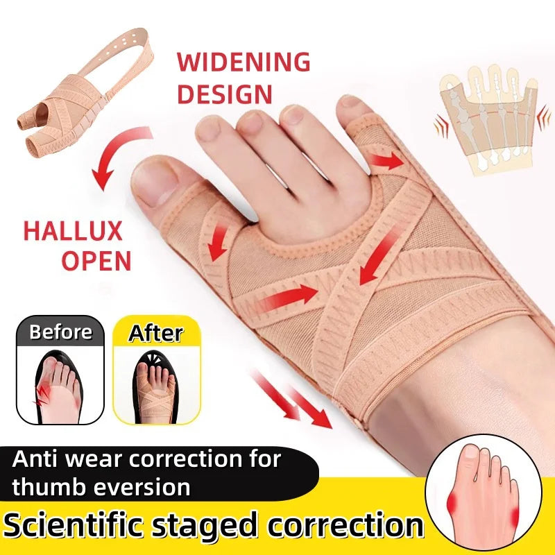 Adjustable Bunion Corrector & Toe Separator – Hallux Valgus Foot Alignment Support 👣