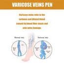 Laser Therapy Pen for Varicose Veins | Blue Light Treatment Device for Pain Relief & Circulation Improvement
