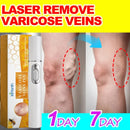 Laser Therapy Pen for Varicose Veins | Blue Light Treatment Device for Pain Relief & Circulation Improvement