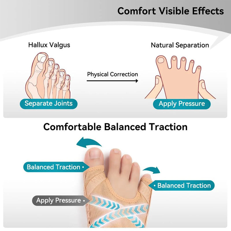 Adjustable Bunion Corrector & Toe Separator – Hallux Valgus Foot Alignment Support 👣