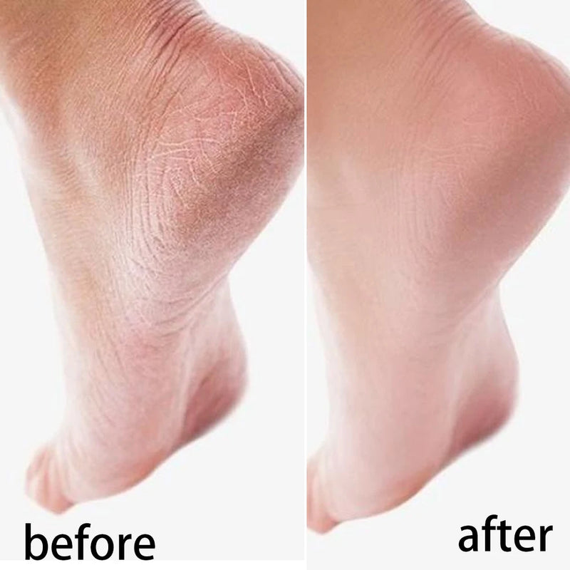 Reusable Silicone Moisturizing Mask Socks & Gloves – Exfoliating, Anti-Crack, and Hydrating Foot and Hand Care Tool